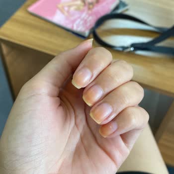 Flormar Oje Tırnaklarda Kalıcı Turuncu Lekeler Bırakıyor