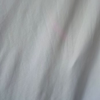 Samsung Galaxy S24 FE Kamera Sorunu: Mor Leke Ve Çizgi Problemi