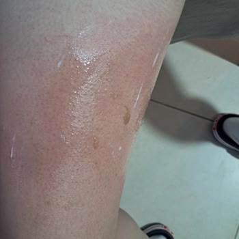 Karton Bardak Noodle Sıcak Ürünle Çocuğumun Yanmasına Sebep Oldu