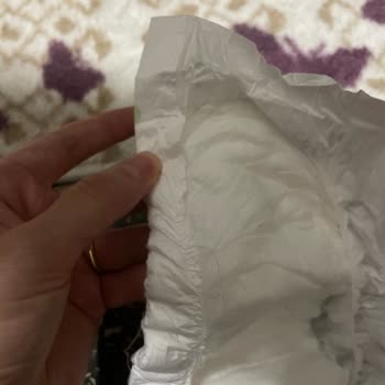 Aldığım Bebek Bezlerinde Yırtık Ve Eksik Cırt Sorunu Yaşadım