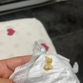 Satın Aldığım Molfix Bebek Bezlerinde Leke Problemiyle Karşılaştım