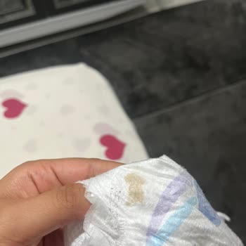 Satın Aldığım Molfix Bebek Bezlerinde Leke Problemiyle Karşılaştım