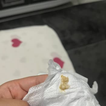 Satın Aldığım Molfix Bebek Bezlerinde Leke Problemiyle Karşılaştım