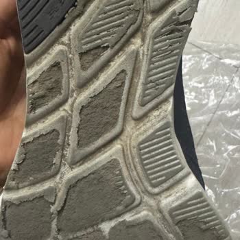 Kısa Sürede Soyulan Ayakkabı Ve Müşteri Hizmetleri Hayal Kırıklığı