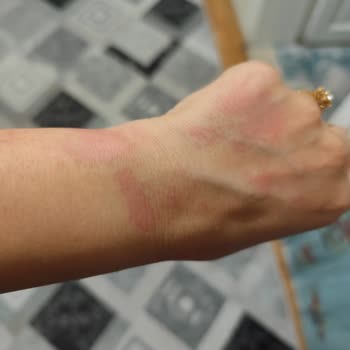 Gülhan Beauty Center Ağdada Yaktılar Bir Daha Gelmeyin Dediler