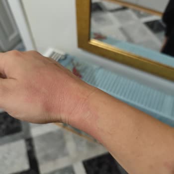 Gülhan Beauty Center Ağdada Yaktılar Bir Daha Gelmeyin Dediler