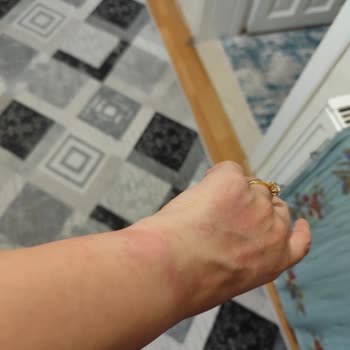 Gülhan Beauty Center Ağdada Yaktılar Bir Daha Gelmeyin Dediler