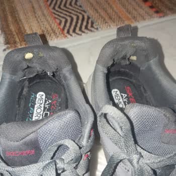 Skechers Ayakkabım 6 Ayda Deforme Oldu Garanti Reddedildi