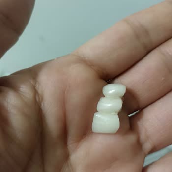 Zirkonyum Kaplama Kırıldı, Klinik Sorumluluk Almadı Ve Çözüm Sunmadı