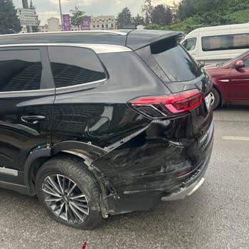 Kaza Anında Airbag Açılmadı, Hayati Tehlike Yaşadım!