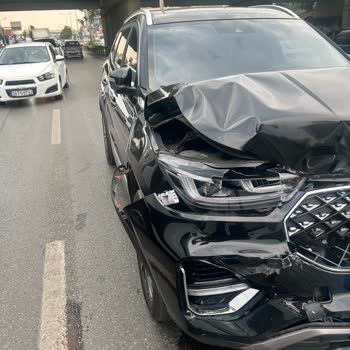 Kaza Anında Airbag Açılmadı, Hayati Tehlike Yaşadım!