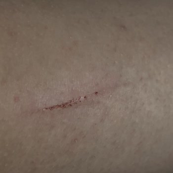 İETT Otobüs Şoföründen Engelli Yolculara Hakaret Ve Şiddet