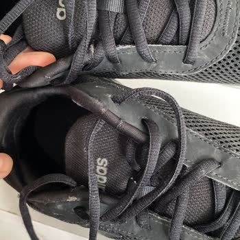 1 Ayda Deforme Olan Adidas Ayakkabı Ve Garanti Sürecinde Mağduriyet