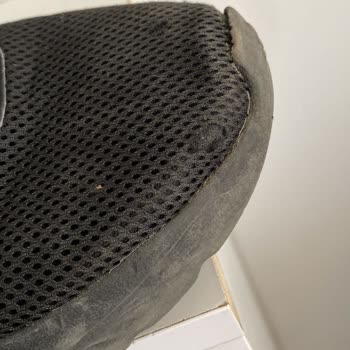 1 Ayda Deforme Olan Adidas Ayakkabı Ve Garanti Sürecinde Mağduriyet