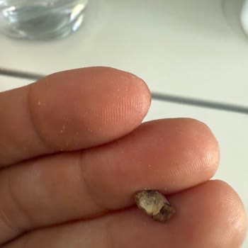 THY Uçuşunda Sandviçten Çıkan Sert Cisim Endişe Yarattı