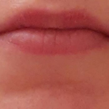 Bilgilendirme Eksikliği Ve Sonuçsuz İşlemler Nedeniyle Ücret İadesi Talebi