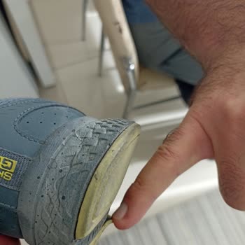 Skechers Ayakkabıda Üretim Hatası Ve İade Talebimin Reddedilmesi Mağduriyet Yarattı