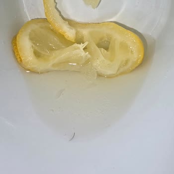 Himalaya Kaya Tuzunda Tekrarlayan Kıl Problemi Ve Sağlık Endişesi