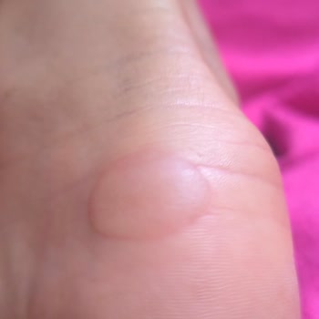 Aldığım Kramponlar Ayağıma Zarar Verdi, İade Talebim Reddedildi