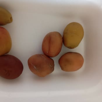 Hastane Yemeklerinde Hijyen Ve Kalite Sorunu