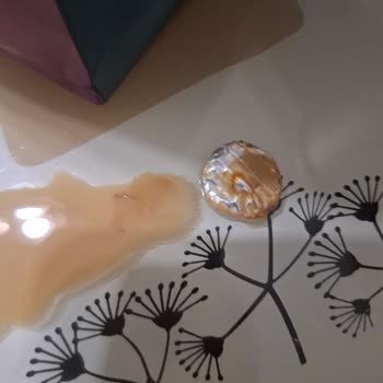 Kahve Siparişimde Yabancı Cisimle Karşılaştım, Sağlığım Tehlikeye Girdi