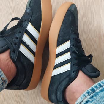 Adidas Ayakkabıda 1 Ayda Renk Solması Ve Çözüm Eksikliği