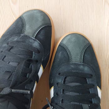 Adidas Ayakkabıda 1 Ayda Renk Solması Ve Çözüm Eksikliği