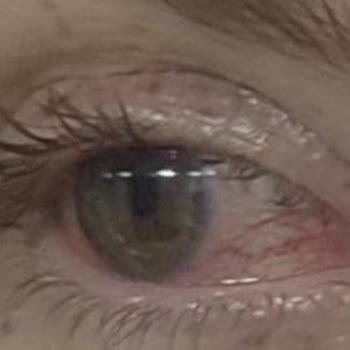 Tedaviye Rağmen İyileşmedim, Kontrol İçin Tekrar Ücret Talep Edildi