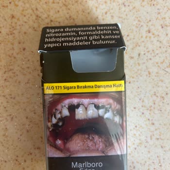 Aldığım Sigara Paketinden Canlı Kurt Çıktı, Hijyen Ve Sağlık Riski Yaşadım