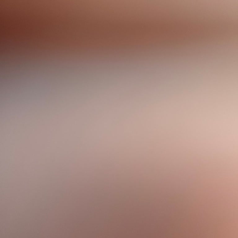 Garantiye Bırakılan Pantolon İçin Bilgilendirme Ve İlgi Eksikliği