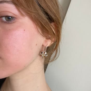 Watsons Micellar Temizleme Suyu Cildimde Şiddetli Alerjik Reaksiyona Sebep Oldu, Müşteri Hizmetleri İlgisiz Kaldı