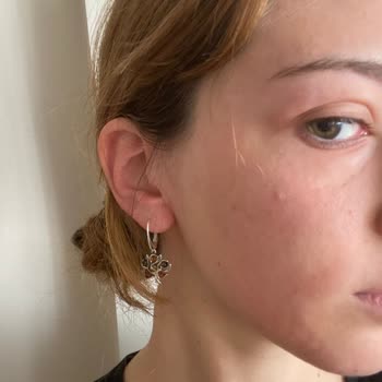 Watsons Micellar Temizleme Suyu Cildimde Şiddetli Alerjik Reaksiyona Sebep Oldu, Müşteri Hizmetleri İlgisiz Kaldı