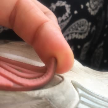 Kinetix Brenda Ayakkabı 2 Ayda Deforme Oldu, Değişim Talebim Var