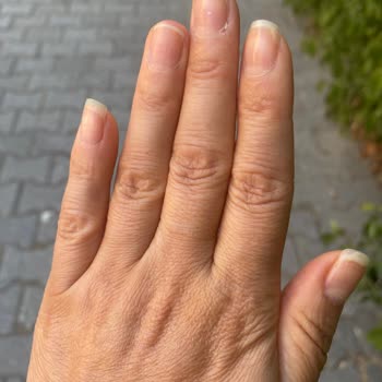 Mehmet Polat Saç Tasarım Atakent Şubesinden Şikayetçiyim