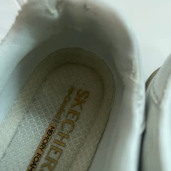 Kısa Sürede Deri Soyulan Ayakkabı İçin Değişim Talebi Ve Hayal Kırıklığı