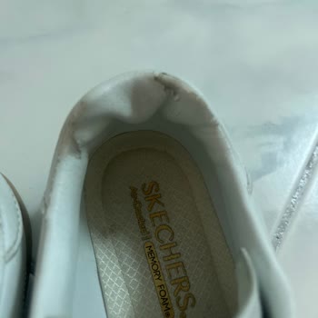 Kısa Sürede Deri Soyulan Ayakkabı İçin Değişim Talebi Ve Hayal Kırıklığı