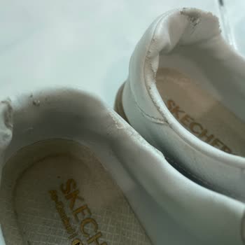 Kısa Sürede Deri Soyulan Ayakkabı İçin Değişim Talebi Ve Hayal Kırıklığı