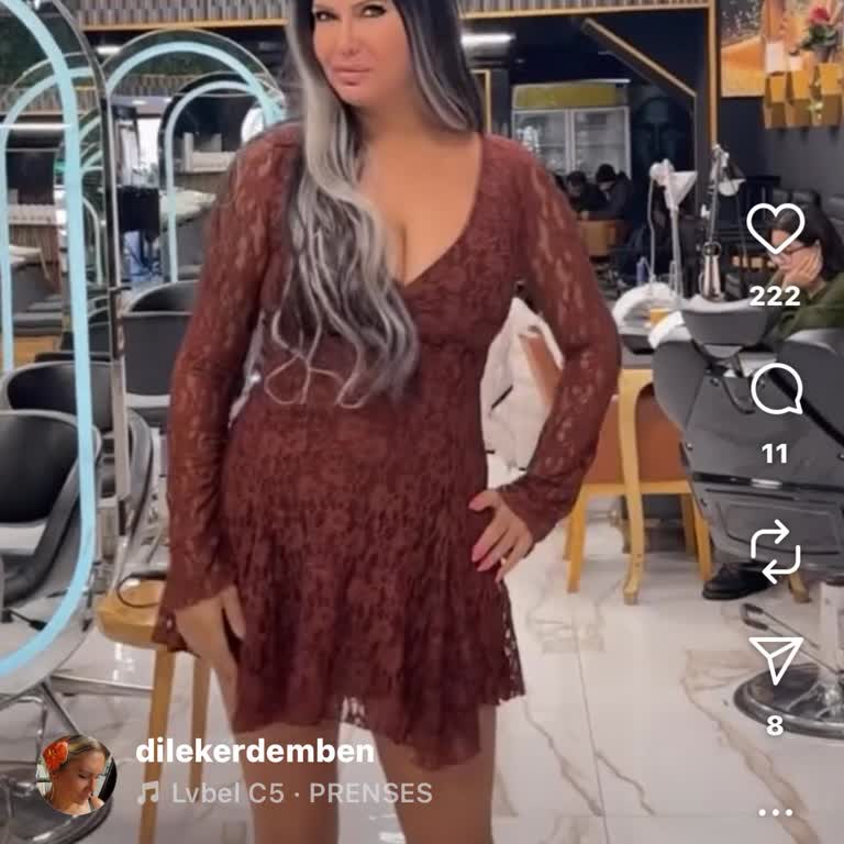 Teslim Ettiğim Saçlarım Kayboldu, Mağduriyetim Giderilmiyor