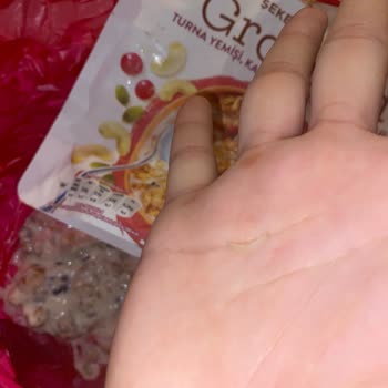Kellogg's Granola İçinden Yabancı Cisim (Tırnak) Çıkması Ve Hijyen Endişesi