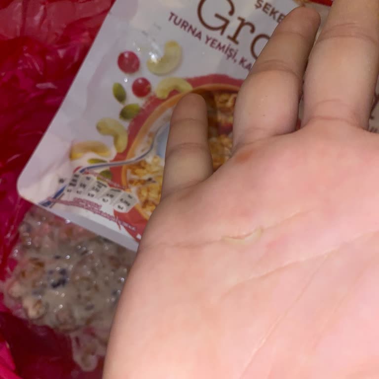 Kellogg's Granola İçinden Yabancı Cisim (Tırnak) Çıkması Ve Hijyen Endişesi
