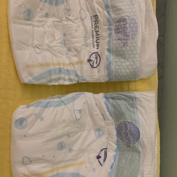 Molfix Premium 3 Bebek Bezinde Kalite Farklılığı Ve Açıklama Talebi