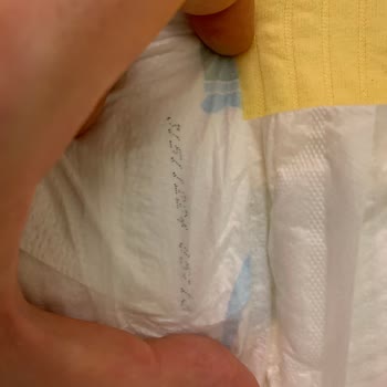 Molfix Premium 3 Bebek Bezinde Kalite Farklılığı Ve Açıklama Talebi