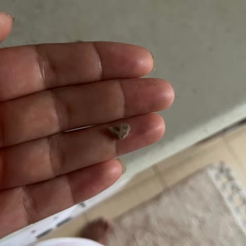 Aldığım Fındık Kremasından Taş Çıktı, Hijyen Konusunda Endişeliyim