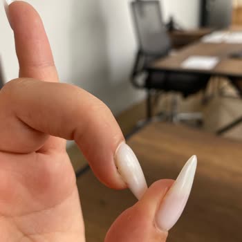 Kapsül Protez Tırnak Sonrası Sağlığım Tehlikeye Girdi