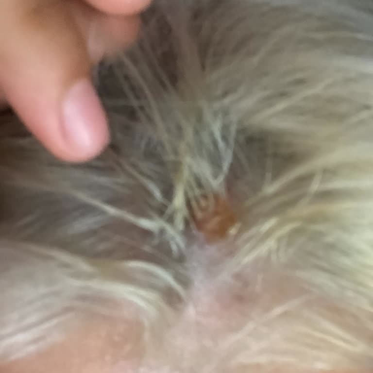 Saç Boyası Sonrası Şiddetli Acı, Şişlik Ve Saç Dökülmesi Yaşadım