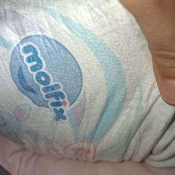 Molfix Bebek Bezi Alerji Yaptı, Müşteri Hizmetlerinden Dönüş Alamadım