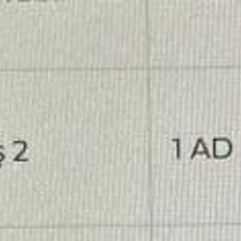 İade Edilen Kargo Ücreti Sözleşmeye Aykırı Şekilde Kesildi