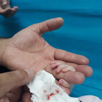 Bebek Ürününde Güvenlik Açığı: Keskin Ayna Çocuğumu Yaraladı