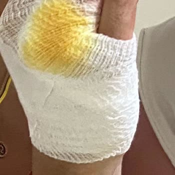 Havuzda Cam Bardak Faciası: Yaralanma Ve İhmalkarlık!