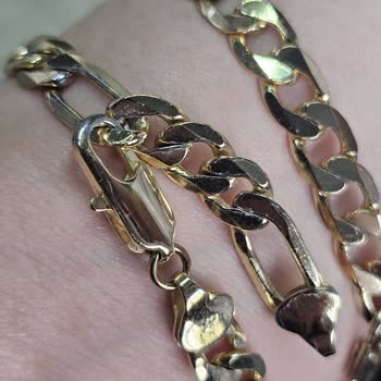 Kısa Sürede Deforme Olan Bileklik İçin Para İadesi Talebim